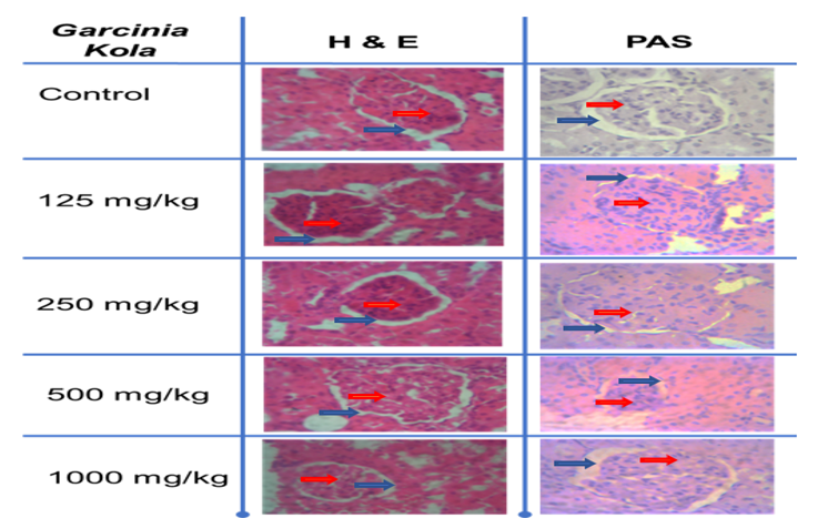H&E (Hematoxylin and Eosin) and PAS (Periodic acids-Schiff) Stain of the Rat Kidney x400, Administered with Ethanolic Extract of Garcinia kola Heckel, the Glomerulus, Bowman Space and Distal Convoluted Tubules of the Control Groups Compared with the Treated Groups shows no Observable/Visible Lesion at 125 and 250 mg/kg doses but they become Smaller as the dose Increases