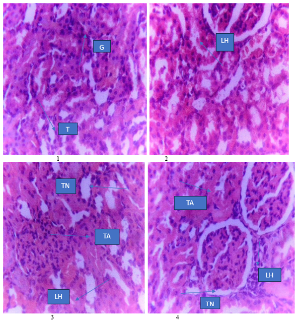 Photomicrographs of the Kidneys of Rats Administered with 250, 500 and 1000 mg/kg of the Methanol leaf Extract of Vitellaria paradoxa Compared with Control (Normal Saline) H and E stain (x 400 Magnification)