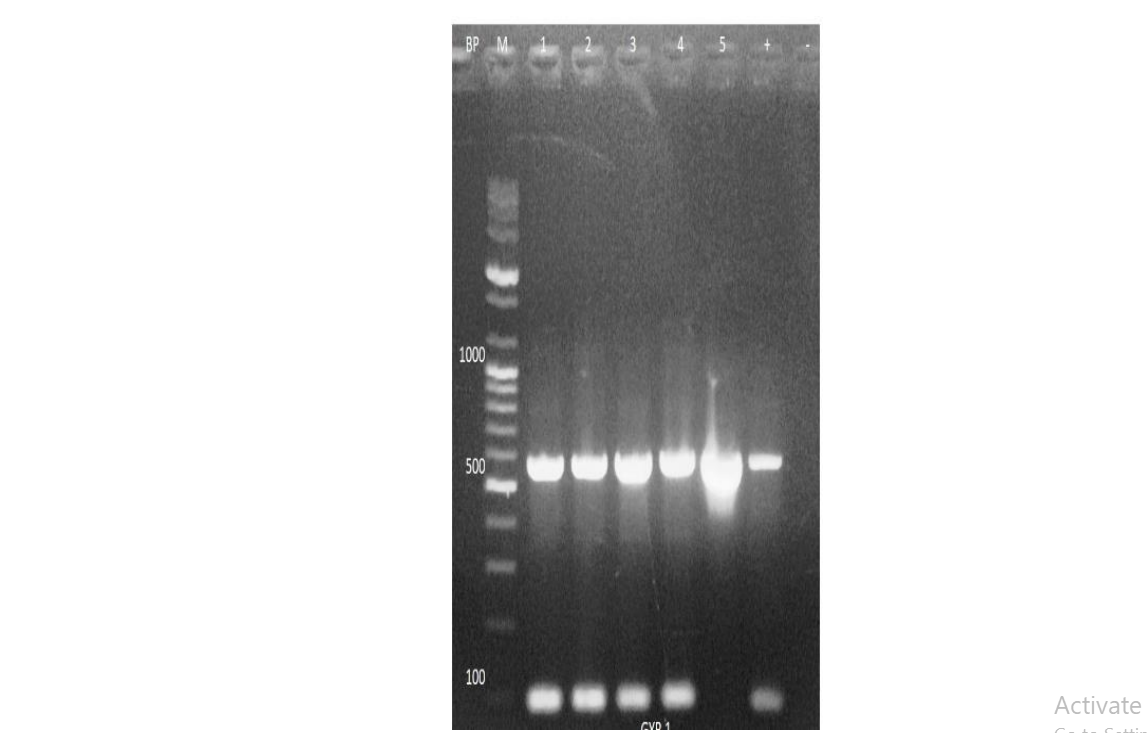 Gel electrophoresis of Salmonella enterica serovar Typhi DNA gyrA