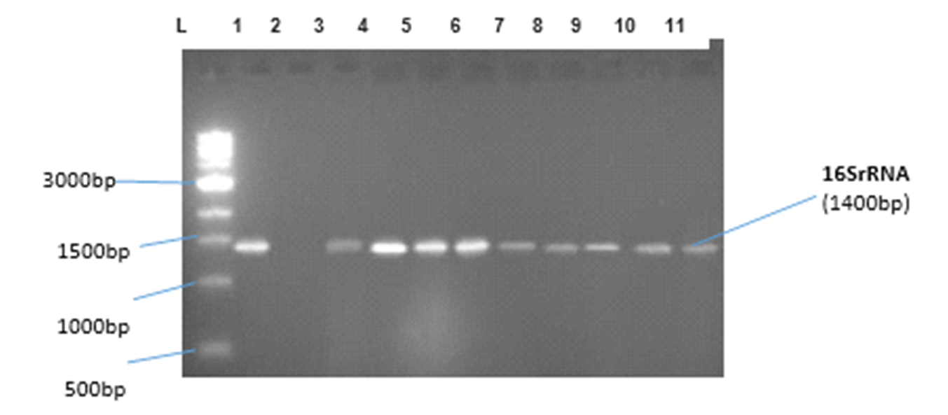 Agarose Gel Electrophoresis of PCR-Amplified 16S rRNA Gene Fragments