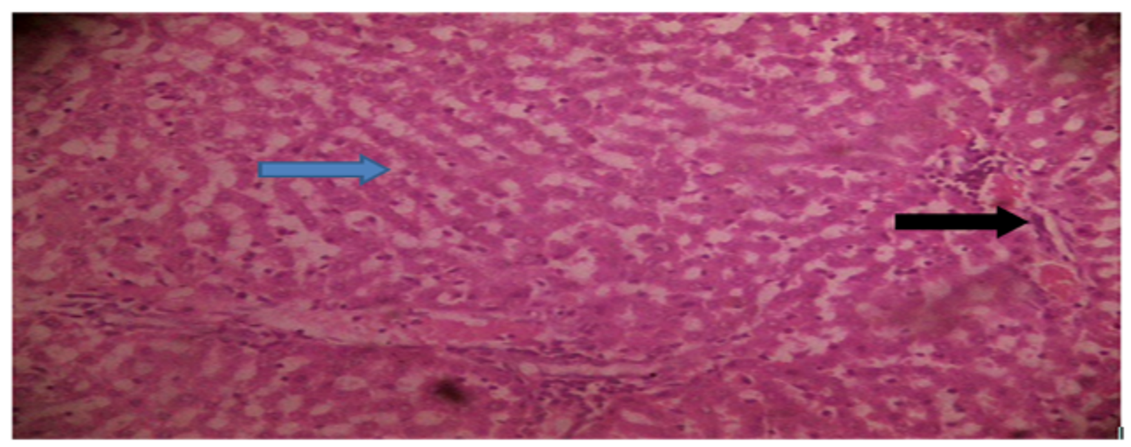 Photomicrograph of liver from the normal control group, showing normal hepatic cords (blue arrow) and a normal portal triad (black arrow)
